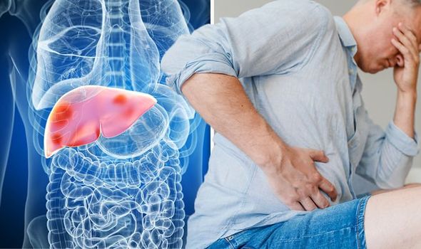 Symptoms of liver damage